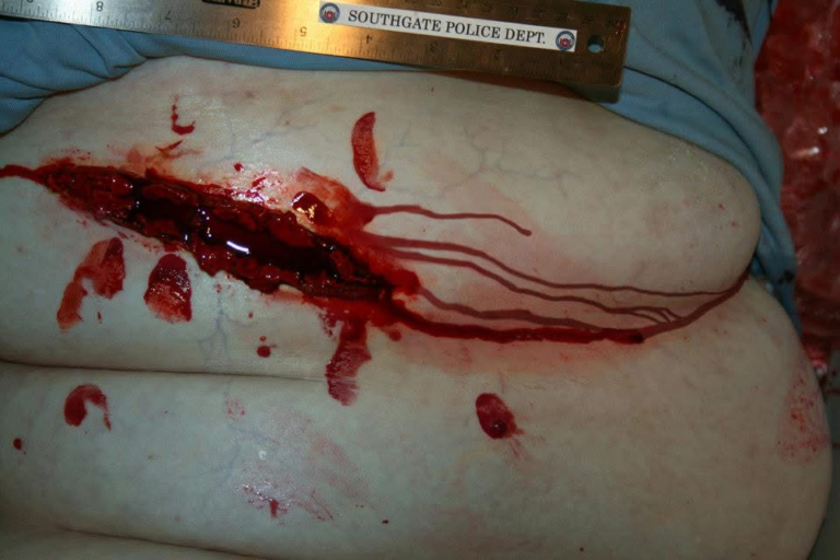Evidence photo